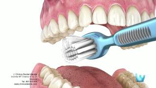 Higiene dental  Clinica identis [upl. by Elenahc798]