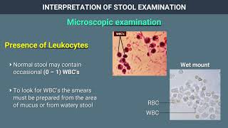 Interpretation of Stool Examination [upl. by Sanfred407]