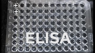 ELISA  How to do ELISA  step by step procedure for ELISA [upl. by Gnil607]