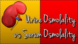 Urine Osmolality vs Serum Osmolality Hyponatraemia [upl. by Donald]