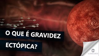 O que é gravidez ectópica [upl. by Galina]