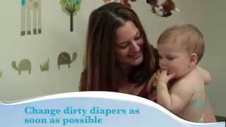 How to treat diaper rash [upl. by Jobi]