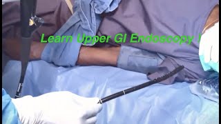 Steps of Diagnostic Upper GI Endoscopy  Dr S Easwaramoorthy [upl. by Metts]