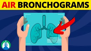 Air Bronchogram Medical Definition  Quick Overview [upl. by Esbenshade]