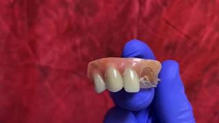 How to fix broken denture tooth [upl. by Hunsinger]