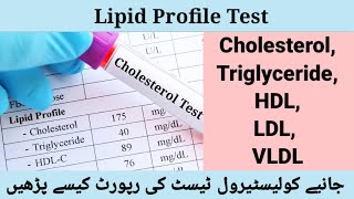 Lipid profileClear explanationLipidprofileMLTMedilabacademyCholesterolTriglycerides [upl. by Metsky]