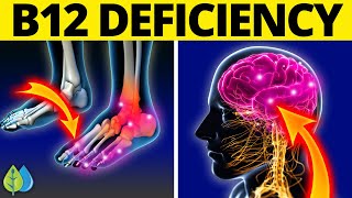 11 Weird Signs You Might Be Lacking Vitamin B12 [upl. by Michele355]