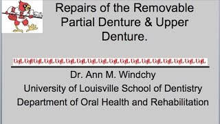 Repairs to the Removable Partial Denture [upl. by Ty]