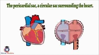 Cardiac Tamponade Pulsus Paradoxus [upl. by Sirtaeb]