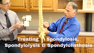 Treating Spondylosis Spondylolysis amp Spondylolisthesis Lumbar Spine [upl. by Hgielek]