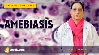 Amebiasis  Entamoeba Histolytica Disease  Infectious Medicine Lectures  VLearning [upl. by Nadabas]