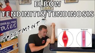 Golfers Elbow Medial Epicondylitis Tendonitis and Tendinosis Treatment [upl. by Katey]