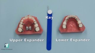 How to Turn an Expander [upl. by Fadiman]