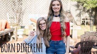 My Identical Twin With Dwarfism  BORN DIFFERENT [upl. by Jesh728]