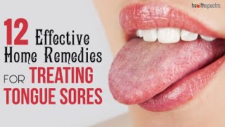 12 Effective Remedies For Treating Tongue Sores  Healthspectra [upl. by Cuthbertson]