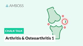 Arthritis amp Osteoarthritis  Part 1 Joint Structure [upl. by Alam]