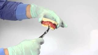 Tutorial 1  extracting forceps [upl. by Cohberg]