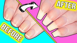 How to GROW YOUR NAILS FAST actually helpful information [upl. by Nevar]