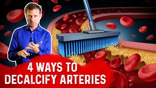 4 Ways To Decalcify Your Arteries – Dr Berg [upl. by Tham262]