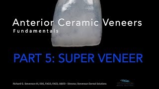 Anterior Ceramic Veneers Part 5 Super Veneer [upl. by Akimit714]