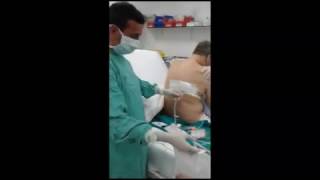 TORACOCENTESIS DIAGNOSTICA Y TERAPEUTICA DERRAME PLEURAL [upl. by Ggerk230]