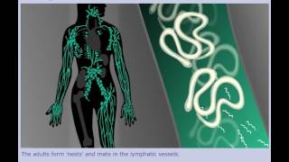 Lymphatic Filariasis Elephantiasis  Life Cycle [upl. by Jehius]