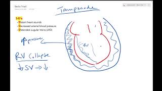 Cardiac Tamponade  Dr Jamal USMLE [upl. by Downing]