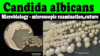 Candida albicans microbiology  microscopic examinationcuturelaboratory diagnosis [upl. by Kaile]