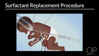 Surfactant Replacement in Neonates by B Walsh  OPENPediatrics [upl. by Dich]