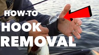 How To Fishing Hook Removal  ANGLER BURIES HOOK IN HAND [upl. by Mcguire713]