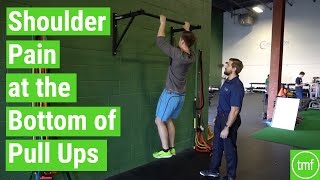 Shoulder Pain During Pull Ups  Ep 112  Movement Fix Monday  Dr Ryan DeBell [upl. by Sebastien]