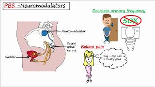 BK virus Hemorrhagic cystitis  an Osmosis Preview [upl. by Walsh]