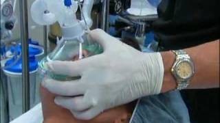 NT About Anesthesia Ch 5  General Anesthesia [upl. by Letniuq]