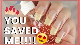 5 PRODUCTS THAT SAVED MY NAILS [upl. by Estas]