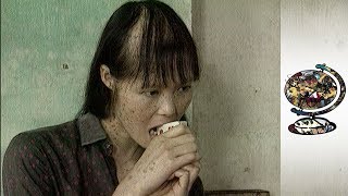 The Horrific Impact Of Agent Orange In Vietnam 2003 [upl. by Ytram]