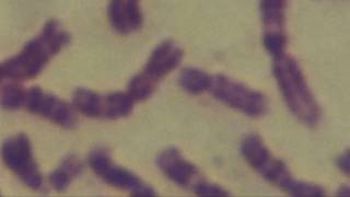 Cytogenetics Human chromosomes Karyotype [upl. by Buff]