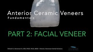 Anterior Ceramic Veneers Part 2 Facial Veneer [upl. by Mel]