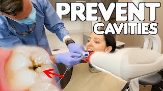 5 Simple Ways To Prevent Cavities [upl. by Ingeberg]