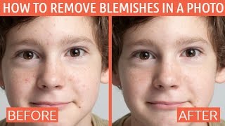 How to Remove Skin Blemishes Spots and Other Imperfections from Photos [upl. by Kamaria430]