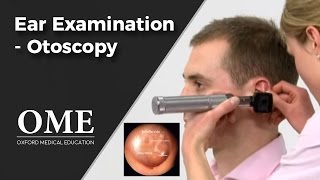 Otoscopy Ear Examination  ENT [upl. by Atinuaj]