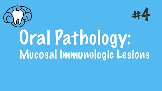 Oral Pathology  Mucosal Immunologic Diseases  INBDE ADAT [upl. by Boelter512]