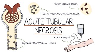 Understanding Acute Tubular Necrosis [upl. by Northrop]