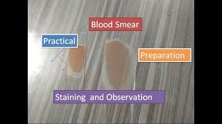 Blood Smear preparation staining and observation [upl. by Andrei]