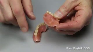 How to Repair Broken Denture [upl. by Varrian]