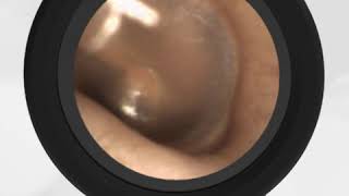 Valsalva ear popping video [upl. by Ridglee724]