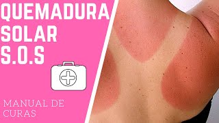 GUÍA RÁPIDA en caso de QUEMADURA SOLAR 🔆 [upl. by Arakal976]