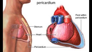 Cardiac Tamponade [upl. by Timmons660]