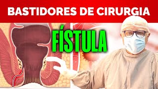 CIRURGIA de FÍSTULA PERIANAL Bastidores Com Dr Paulo Branco Proctologista [upl. by Rondon]