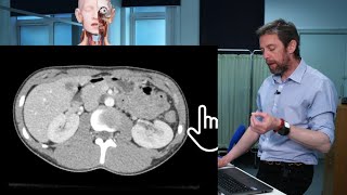 Abdomen transverse CT imaging anatomy [upl. by Shalna22]