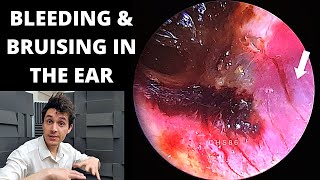 THE EAR the Anatomy amp Physiology of Hearing by Professor Fink [upl. by Eiresed]